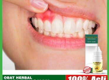 obat herbal untuk sakit gigi